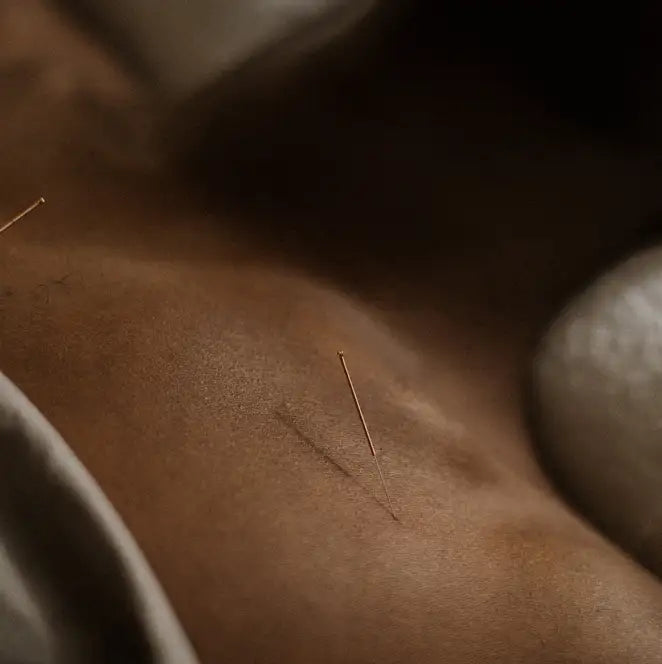 Redmint Acupuncture Holistic Health